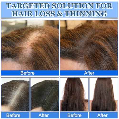 Advanced Hair Growth Roll on, Nourishes Scalp & Roots, Vitamin E & Natural Oils, Promotes Growth, Reduces Hair Loss(10ml) - For Men & Women (3PCS)