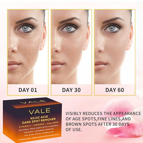 VALE Kojic Acid & Turmeric Soap Bar (2-Pack) ? Natural Dark Spot Remover & Original Japanese Complex with Vitamin C, E, Collagen, Retinol, Olive Oil & Shea Butter(Citrus)