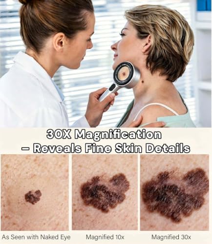 30x Portable Magnifying Dermatoscope with LED Light Modes for Skin & Scalp