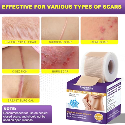 Silicone Scar Sheets, Silicone Scar Tape, Scar Tape for Keloid Bump Removal, Reusable Silicone Scar Strip for C-Section, Keloid, Surgery, Burns, Acne Scar et(1.6¡±x120¡±Roll-3M)