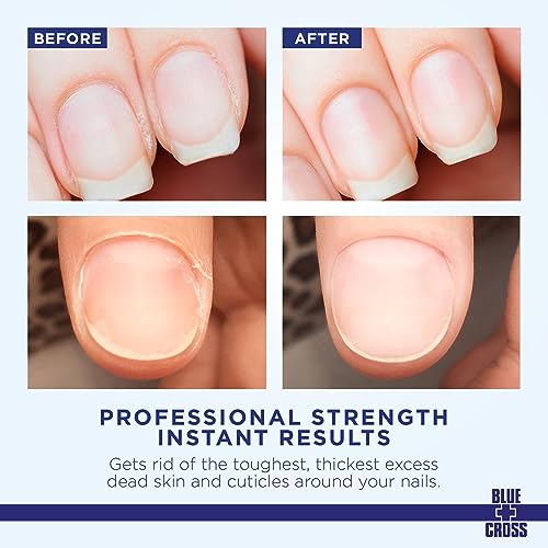 Blue Cross Hydrating, Moisturizing, Strengthening Cuticle Remover Oil with Lanolin + Extra Strength Callus Remover Gel for Heel or Feet, 16 oz each, 2 pack Bundle