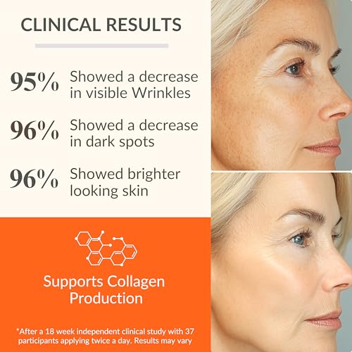 LeVaye Vitamin C Serum, Anti-Aging Face Serum ? 15% Vitamin C, Ferulic Acid, Niacinamide, Hyaluronic Acid, Peptides, Ceramides ? Targets Wrinkles, Fine Lines, Dark Spots, Enlarged Pores, Dry Skin