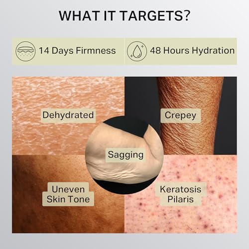 Firming Retinol Body Lotion for Crepey Skin & Keratosis Pilaris - 10.14 fl oz