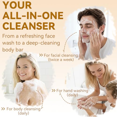 Sulfur Acne & Body Soap Bar 10% - Pack of 6, Face & Skin Treatment