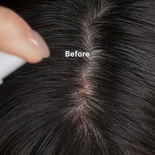 Kelp Scalp Serum Hydrating Treatment for Dry & Itchy Scalp - Natural Hair Growth