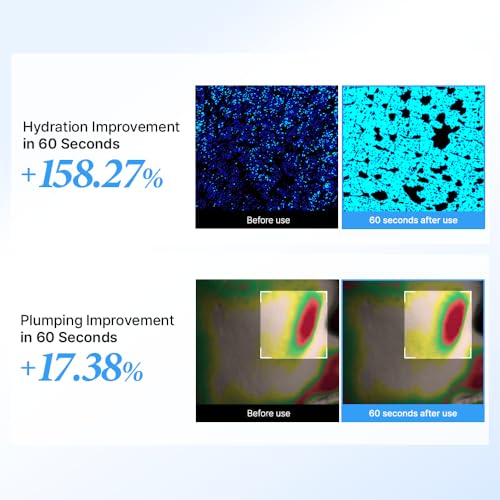 BeginS Hyaluronic Acid Moisturizer Serum with Rice PDRN & Blue Hydrangea for Deep Hydration