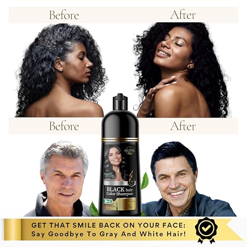 Solutrel Black Hair Dye Shampoo – 10-in-1 Ammonia-Free, Gray Coverage for Men & Women (Variation: Black)
