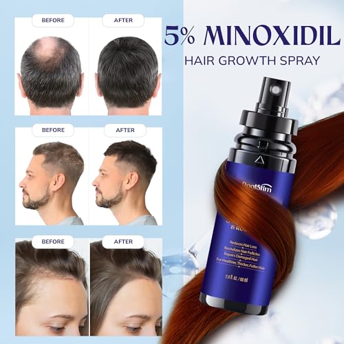 Minoxidil Hair Growth Serum 2-Pack 60ML Extra Strength for Men & Women with Rosemary - Variation of THIS listing