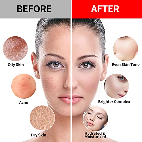 Vampire + Fresh Mint Jelly Mask, Facial Skin Care- Collagen Peel-Off Jelly Mask Set For Facials, Face Mask For Instant Hydration, Vegan Peel Off Face Mask, For Refreshing