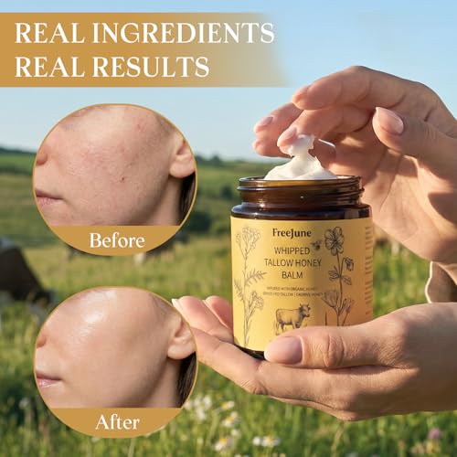 Beef Tallow for Skin Balm with Honey - 5.3 OZ Nourishing Moisturizer - Honey Variation