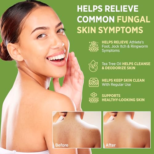 Roycederm Antifungal Bar Soap - Tea tree Oil Soap - Athlete¡¯s Foot Treatment for Jock Itch & Ringworm - Medicated Antifungal Soap with Clotrimazole 1% - Tea Tree Oil Scent, 1 Pack
