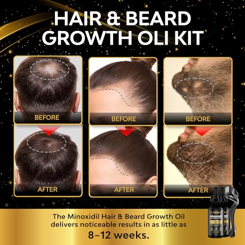 Beaueli Minoxidil 5% Beard Growth Kit – 2 Bottles, 60ml Each, 2 Fl Oz Pack