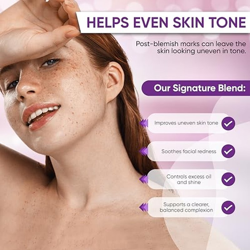 Azelaic Acid Cream for Face: Redness-Soothing Azelaic Acid Facial Cream for Uneven Tone, Blemish-Prone Skin, Pore Care and Skin Clarity Support, 1 oz