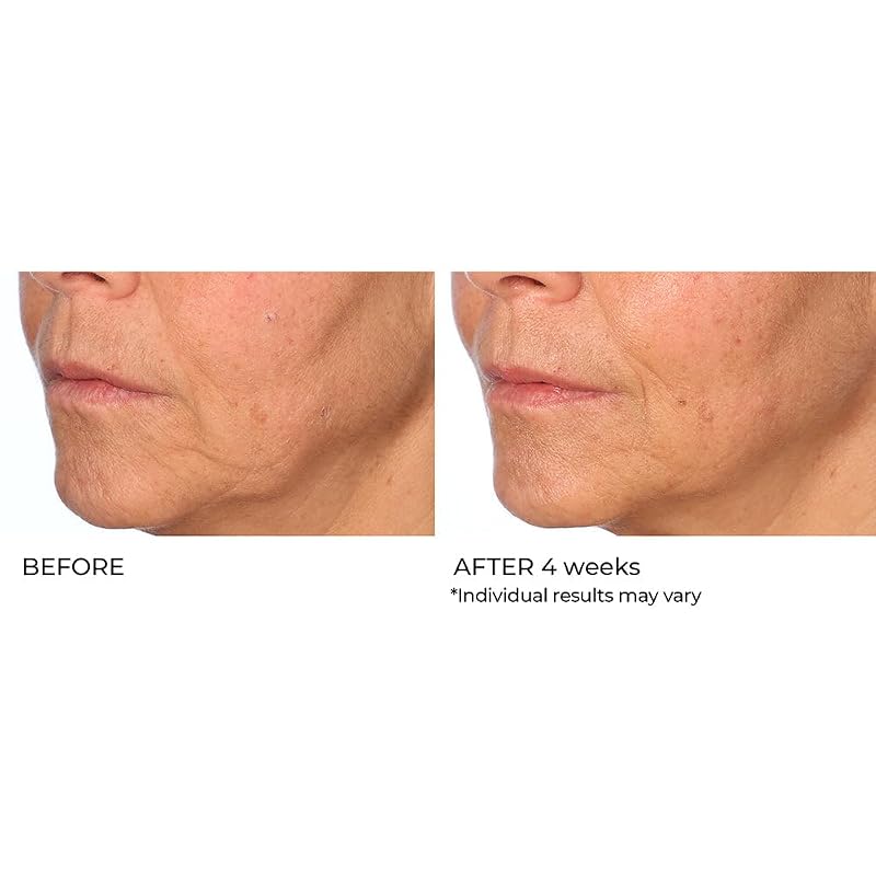 Vitamin C Serum with Omega-3 & Squalane for Brightening & Hydration