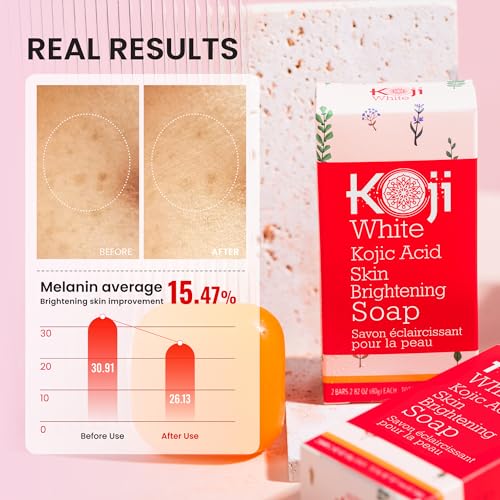 Koji White Kojic Acid Soap & Face Serum Bundle | Glycerin Soap Bar with Vitamin C, Tea Tree & Coconut Oil + 2% Kojic Dipalmitate Serum with 3% Tranexamic Acid, Niacinamide - Vegan, for Radiant Skin