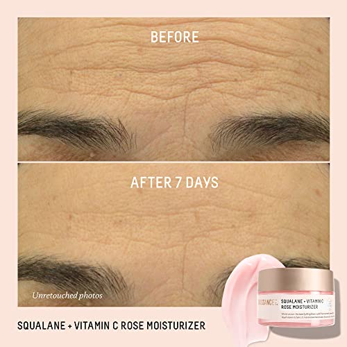 Biossance Squalane + Vitamin C Rose Face Moisturizer ? Antioxidant-Rich Day/Night Face Lotion ? Hydrates and Smooths Fine Lines ? Even Skin Tone & Reduce Discoloration ? For Radiant Skin, 1.69 Fl Oz