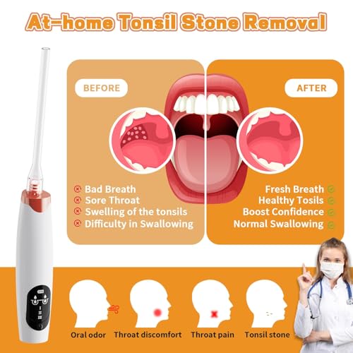 Electric Tonsil Stone Remover Vacuum Kit with Magnifier LED Light & Cleaning Tools