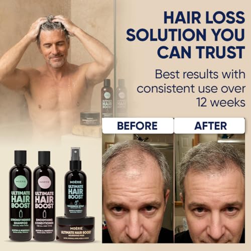 Moerie Hair Growth Set with Biotin & Rosemary – Shampoo, Conditioner, Mask & Spray – 4 Items (Single Set)