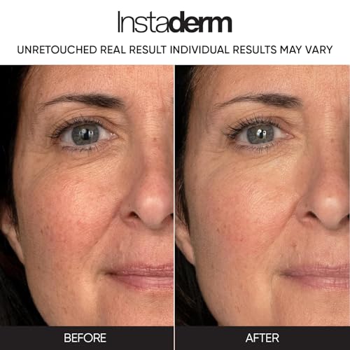 Retinol Skin Booster Cream- Anti Aging Formula with Hyaluronic Acid, Fight Fine Lines, Wrinkles, Post-Acne Scars, Dark & Age Spots. Improve Firmness, Elasticity, Thickness of Skin, & Evens skin Tone.