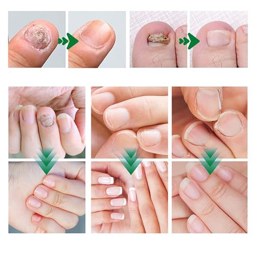 Exfoliating Foot Peel Mask with AHA/BHA & 4 Fruit Extracts ? Removes Dead Skin & Calluses for Baby Soft Feet ? Foot Peeling Mask Socks for Dry, Cracked Feet (4 Pairs)