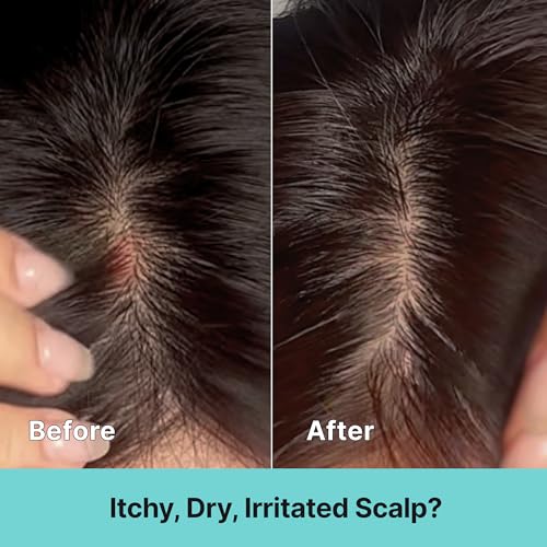 Kelp Scalp Treatment Spray for Itchy & Sensitive Scalp – Lightweight Korean Leave-In Essence 80ml