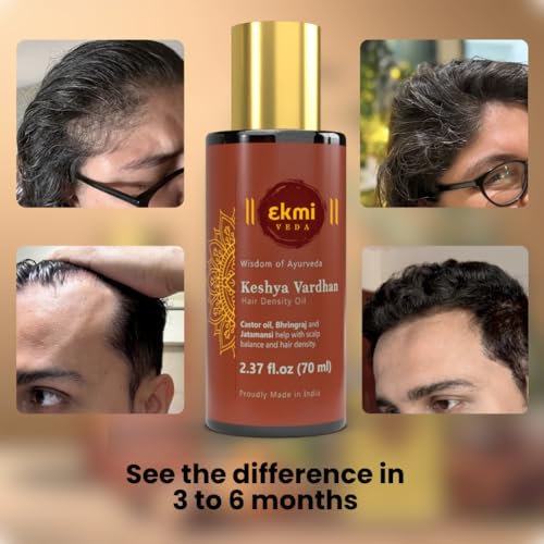 EKMIVEDA Ayurvedic Hair Growth Oil with Castor & Rosemary for Thicker Hair 2.37 Fl Oz