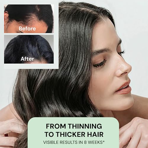 Vello Vital Scalp Serum for Fuller Hair - 90ml, Lightweight & Nourishing