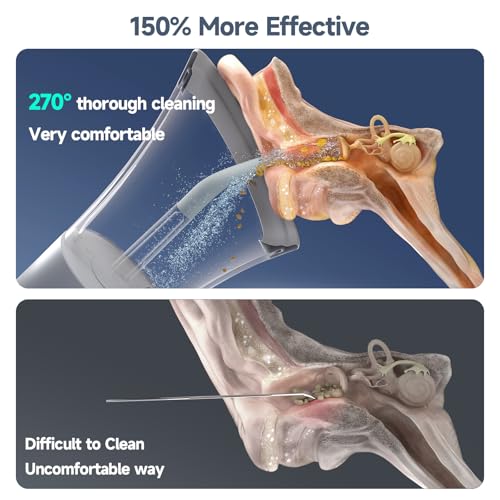 Morfone Electric Ear Wax Removal Kit - Slate Gray, Safe & Rechargeable