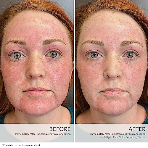 HydroPure Tinted Facial Serum with Green Tint – Hydrating, Sheer Coverage, Plumps & Soothes Skin