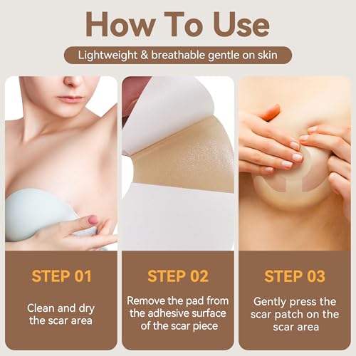 Including 8 Areola Soft Strips & 4 Anchor Sheets, Silicone Scar Sheets for Breast - Medical Grade Breast Silicone Scar Tape Patches for Surgical Scars