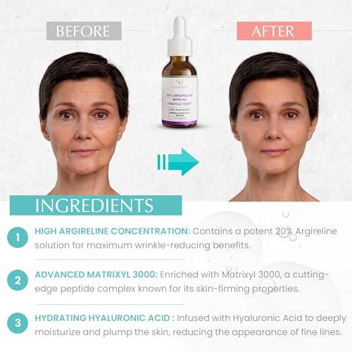 Youth Elixir - Roll On Facial Serum For Under Eyes and Face with Certified Organic, Cold Pressed, Hexane Free Castor, and Frankincense Oil - Miracle Anti-Aging Oil 10mL