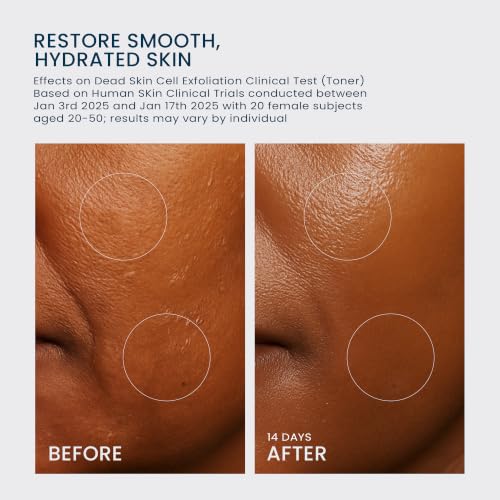 Mimmua Niacinamide Gentle Exfoliating Milky Toner for Sensitive Skin