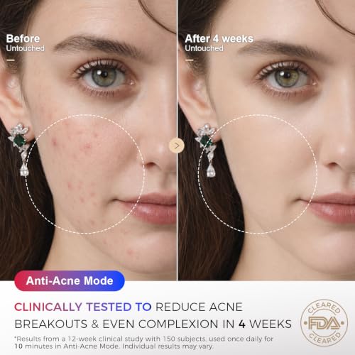 BONLIBRO FDA Cleared Red Light Therapy Face Mask 850nm NIR for Skin Rejuvenation