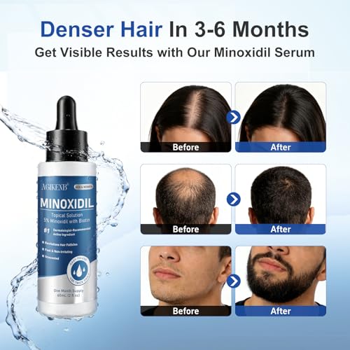 Minoxidil Hair Growth Serum 8-Pack with Biotin for Men & Women, Thicker Hair & Beard