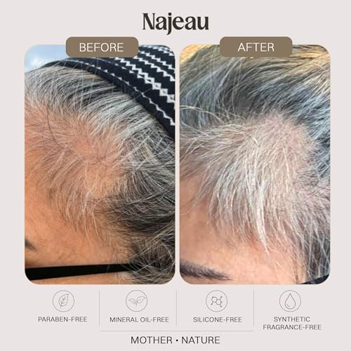 Najeau Copper Hair Loss Treatment for Thinning Hair - Vegan, Paraben-Free