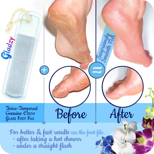 GLADZY Glass Nail File Set ? Czech Crystal Nail Files for Natural Nails, Glass Foot File Callus Remover, Professional Manicure & Pedicure Kit for Fingernails & Toenails with Case and Towel, Made in EU