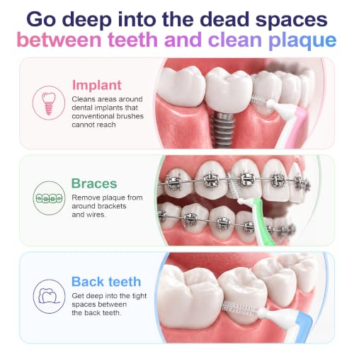 Interdental Brushes for Tight Gaps - 4 Boxes / 20 Pieces, Angled Dental Cleaners for Braces & Back Teeth