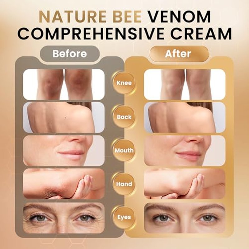 Bee Venom Cream - Natural Bee Venom Skin Treatment Cream - Firming & Wrinkle Reduction, Collagen Boost & Skin Brightening, Moisturizer for Face & Body, All Skin Types, 2.1oz