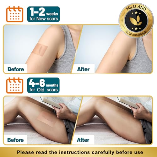 Arme Silicone Scar Tape, Silicone Scar Sheets for Surgical Scars(1.6"x180" Roll-4.6M), Medical Grade Scar Tape Reusable Sheets for Scar Treatment, Soft Scars Tapes for C-Section Keloid Tummy Tuck