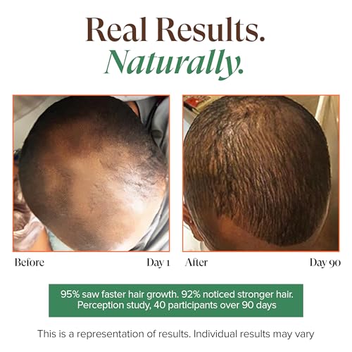 Haitian Black Castor Oil with Rosemary & Peppermint - Cold Pressed, 3.4 Fl Oz, Pack of 2 - Hair & Skin Moisturizer