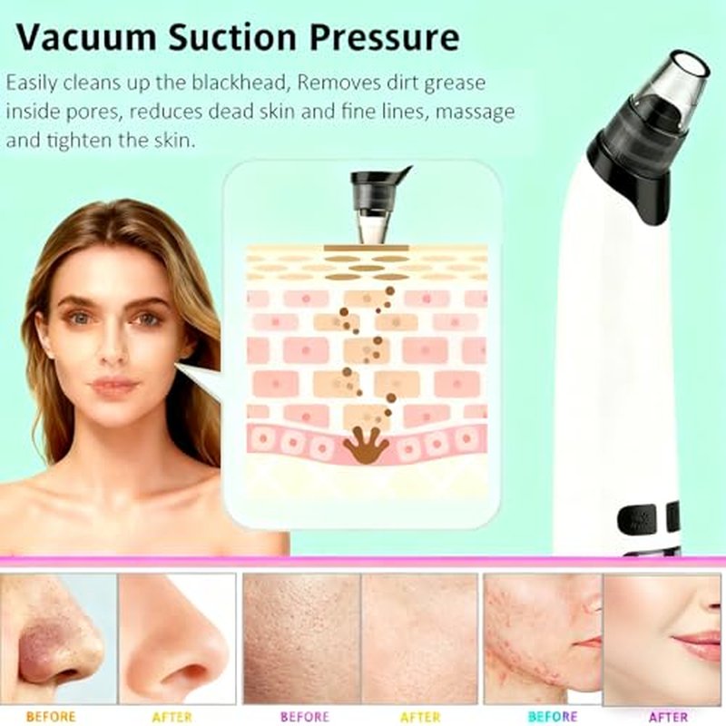 Blackhead Remover Pore Vacuum,Deeply Black Head Remover for Face,4 Pore Sucker Tools,3 Adjustable Suction Levels LED Display, USB Charging with hot Compress Extractor Tool for Women & Men