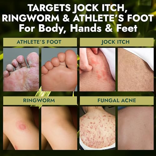 Antifungal Tea Tree Soap 2 Pack with Scrubber for Jock Itch & Ringworm