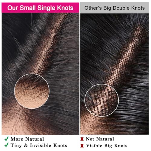 5x5 Transparent HD Lace Closure - Silky Straight Human Hair, Pre-Plucked, 16 Inch