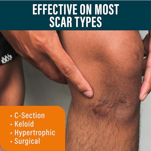 NUVADERMIS Silicone Scar Sheets & Scar Gel Kit for Post-Surgery & Acne Scars