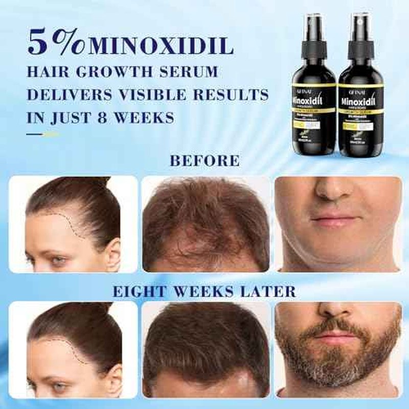 5% Minoxidil Spray for Men and Women with Biotin and Rosemary Hair Growth Serum (Glass Bottle), 5 Percent Minoxidil for Women Spray for Thicker Fuller Hair