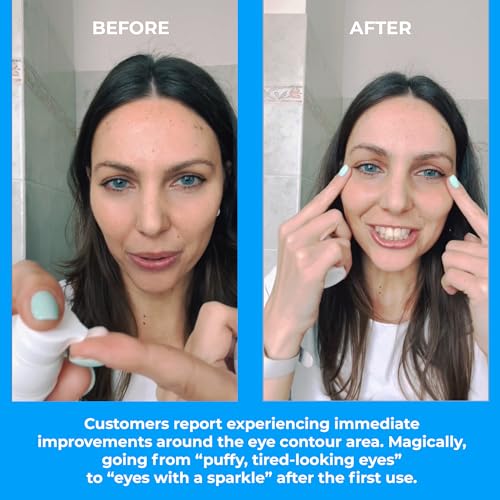 BERTOLI Firming Eye Serum for Wrinkles, Dark Circles & Puffiness ? Under Eye Anti-Aging Serum with Hyaluronic Acid, Olive Oil, Chamomile & Red Grape Polyphenols ? Made in Italy