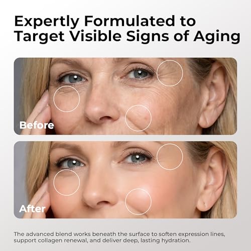 SKIN DEVA 20% Argireline Serum with Matrixyl 3000 Pure Hyaluronic Acid Serum For Face Deep Wrinkle Reducer Anti Aging Tones Skin and Stimulates Collagen Peptides Serum For Face - Pack of 2