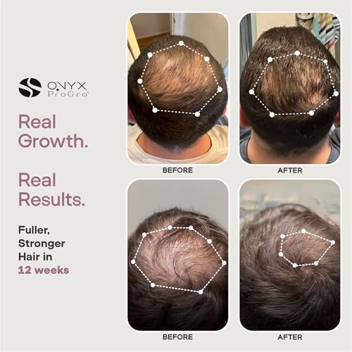 Hair Growth Serum for Women & Men – Oil-Free, Peptide & Biotin Formula