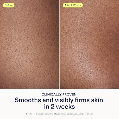 AHA/BHA Body Cream with Fruit Extracts - Exfoliating Moisturizer for Radiance - Vegan Cruelty-Free - 10 oz