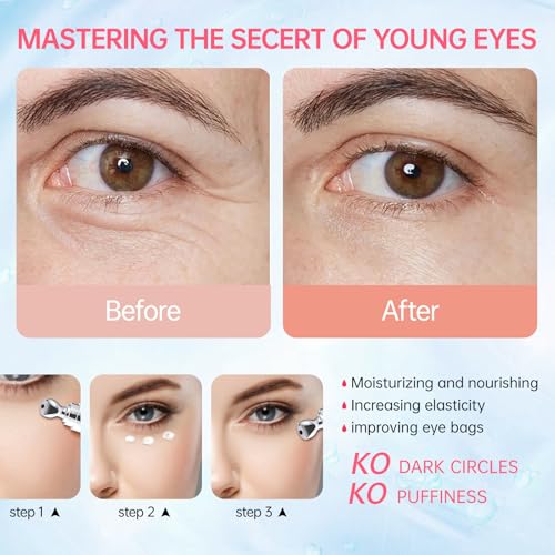 Instant Reduction of Eye Bags-Retinol Eye Cream Dark circles,Relieves Dark Circles And Puffiness, Youth Eye Cream: Smooth Wrinkles,Hydrating, Tightens The Delicate Skin Under The Eyes 0.7 OZ -AU